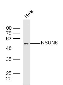 NSUN6 Rabbit Polyclonal Antibody