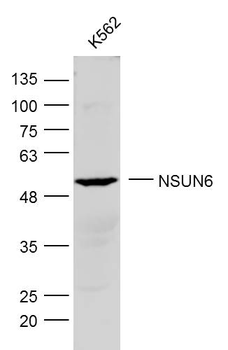 NSUN6 Rabbit Polyclonal Antibody