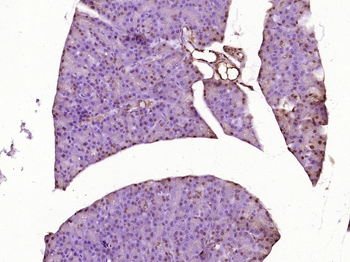NVL Rabbit Polyclonal Antibody