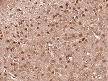 Phospho-NFKB2 (Ser870) Rabbit Polyclonal Antibody