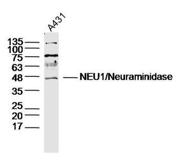 NEU1/Neuraminidase Rabbit Polyclonal Antibody