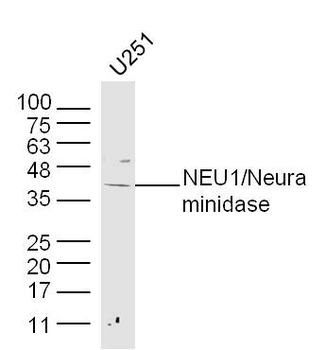 NEU1/Neuraminidase Rabbit Polyclonal Antibody