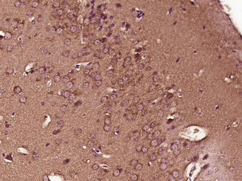 Phospho-NFKB1 (Ser373) Rabbit Polyclonal Antibody