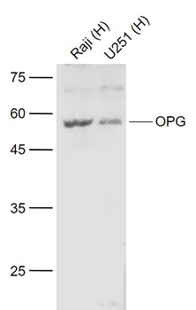 OPG Rabbit Polyclonal Antibody