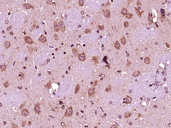 Olfactory Marker Protein Rabbit Polyclonal Antibody