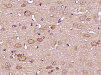 OLFM2 Rabbit Polyclonal Antibody