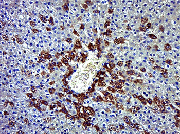 OMA1 Rabbit Polyclonal Antibody