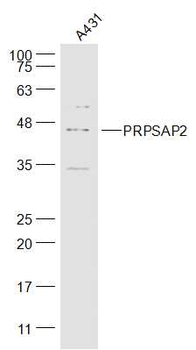 PRPSAP2 Rabbit Polyclonal Antibody