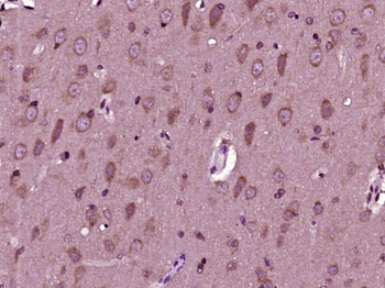 Prune homolog 2/C9orf65 Rabbit Polyclonal Antibody