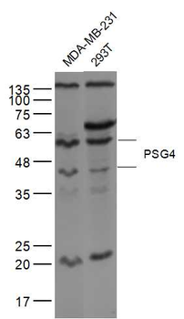 PSG4 Rabbit Polyclonal Antibody