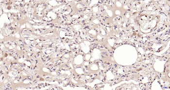 PSMA8 Rabbit Polyclonal Antibody