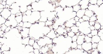 PSMA8 Rabbit Polyclonal Antibody