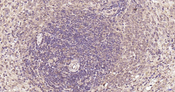 PSMA8 Rabbit Polyclonal Antibody