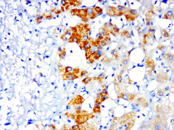 PSMD14 Rabbit Polyclonal Antibody