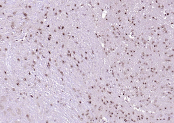 PSMD14 Rabbit Polyclonal Antibody