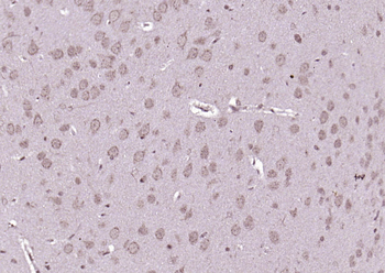 PSMD14 Rabbit Polyclonal Antibody