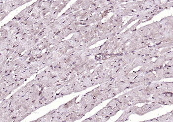 PSMD14 Rabbit Polyclonal Antibody
