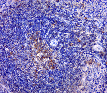 PSME1 Rabbit Polyclonal Antibody