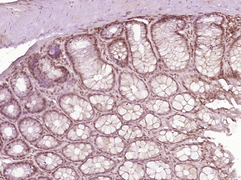 PUF60 Rabbit Polyclonal Antibody