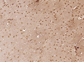 PUF60 Rabbit Polyclonal Antibody