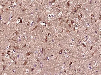Phospho-Parkin (Ser131) Rabbit Polyclonal Antibody