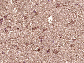 Phospho-Parkin (Ser65) Rabbit Polyclonal Antibody