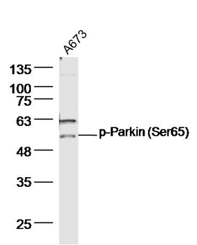 Phospho-Parkin (Ser65) Rabbit Polyclonal Antibody