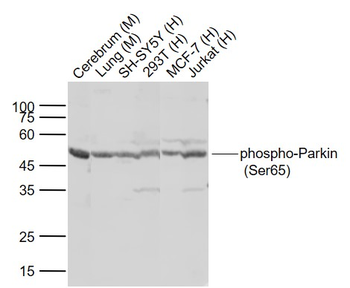 Phospho-Parkin (Ser65) Rabbit Polyclonal Antibody