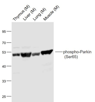 Phospho-Parkin (Ser65) Rabbit Polyclonal Antibody