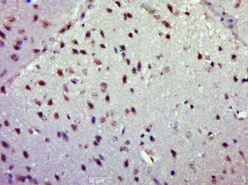 PASK/STK37 Rabbit Polyclonal Antibody
