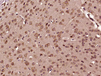 PCBP2 Rabbit Polyclonal Antibody