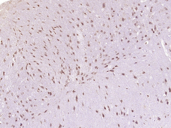 Prickle 2 Rabbit Polyclonal Antibody