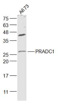 PRADC1 Rabbit Polyclonal Antibody