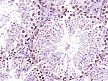 PRDM13 Rabbit Polyclonal Antibody