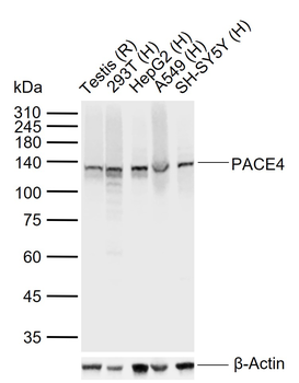 PACE4 Rabbit Polyclonal Antibody
