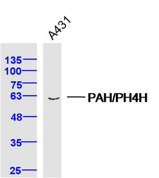 PAH Rabbit Polyclonal Antibody
