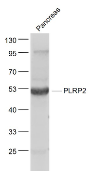 PLRP2 Rabbit Polyclonal Antibody