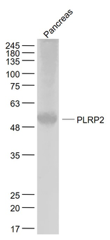 PLRP2 Rabbit Polyclonal Antibody