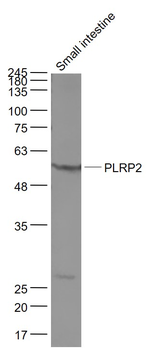 PLRP2 Rabbit Polyclonal Antibody