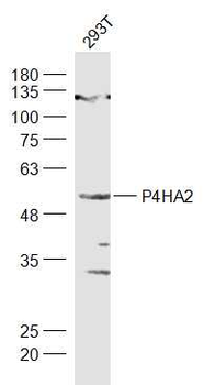 P4HA2 Rabbit Polyclonal Antibody