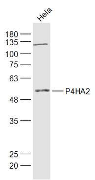 P4HA2 Rabbit Polyclonal Antibody