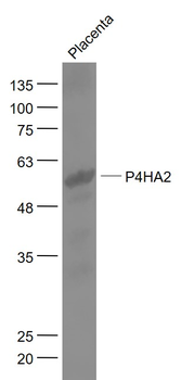 P4HA2 Rabbit Polyclonal Antibody
