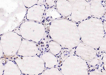 Phospho-PDCD4 (Ser67) Rabbit Polyclonal Antibody