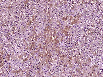PEX14 Rabbit Polyclonal Antibody