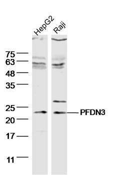 PFDN3 Rabbit Polyclonal Antibody