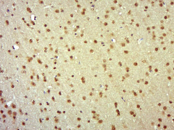 PKN1 Rabbit Polyclonal Antibody