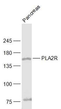 PLA2R Rabbit Polyclonal Antibody