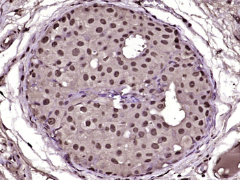 PLK2 Rabbit Polyclonal Antibody