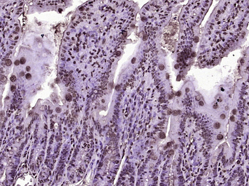 PLK2 Rabbit Polyclonal Antibody