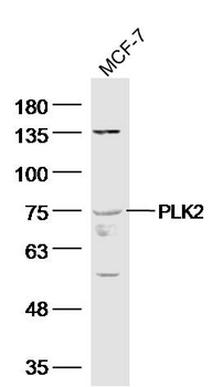 PLK2 Rabbit Polyclonal Antibody